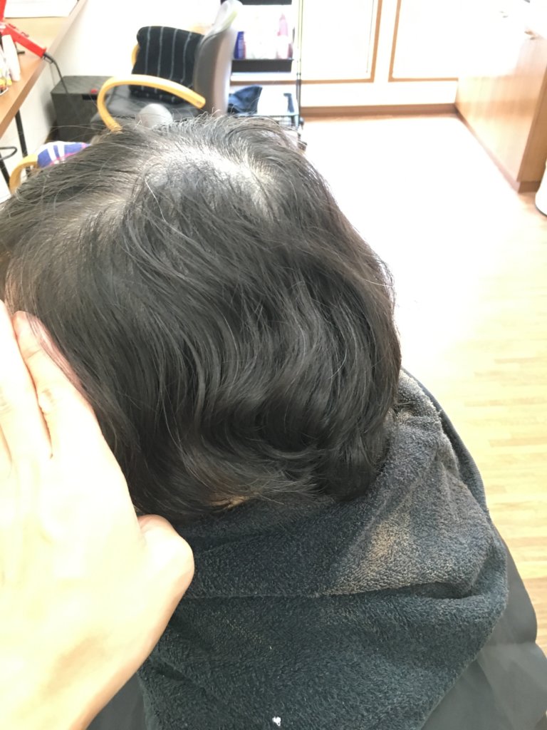 髪の毛