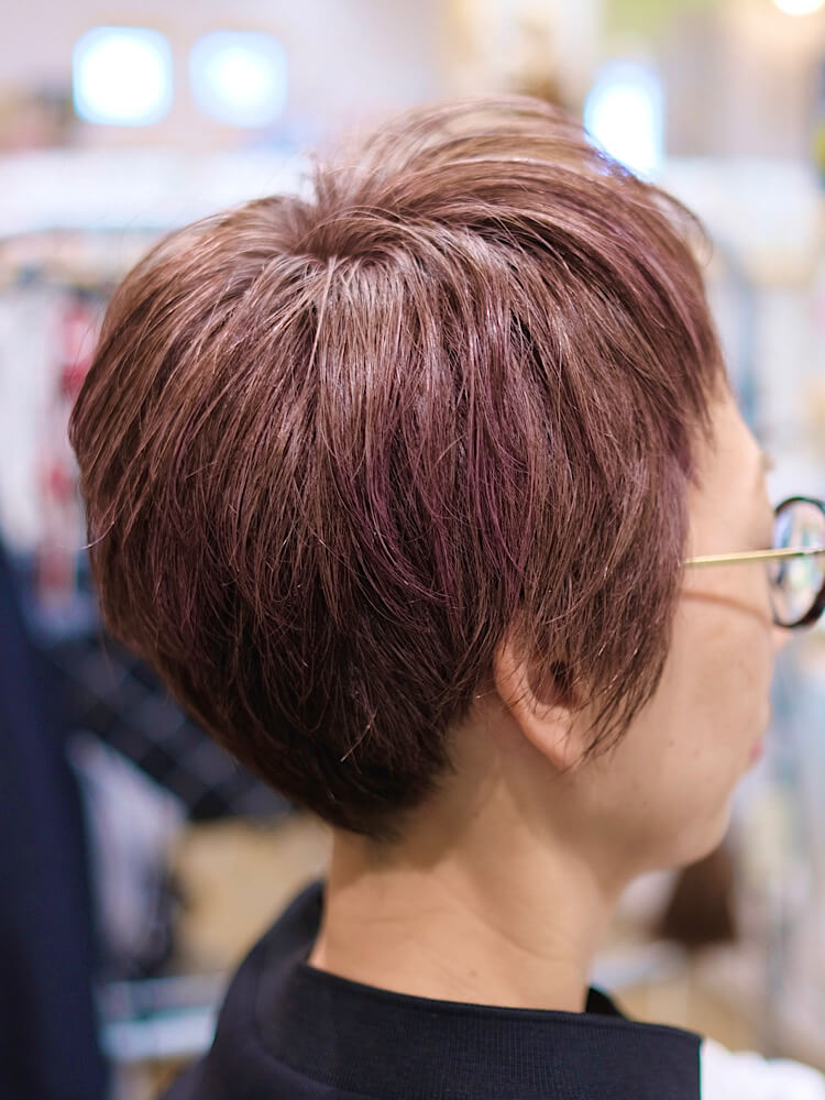 抗がん剤治療後の脱ウイッグのヘアスタイル